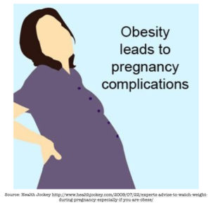 Keeping Pregnant Mothers Safe from Blood Clots: Managing the Healthcare Risk in Obese Patients