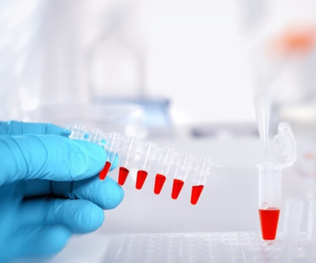 S9: Biomarkers and Antimicrobial Stewardship – The Synergies to Diagnose Sepsis and to Prevent AMR