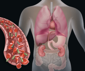 S6: Advances in Timely Pathogen and Sepsis Detection