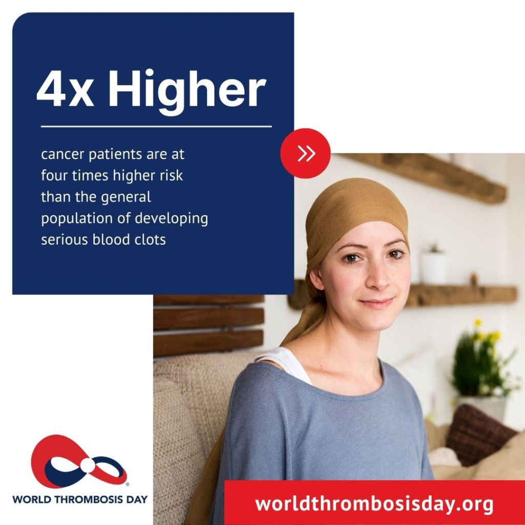 Blood Clots in Cancer Pstients